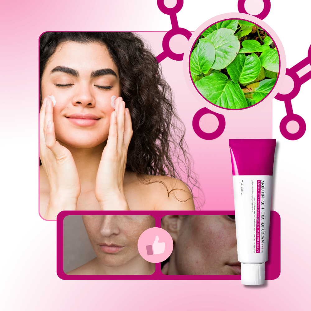 Even Skin Tranexamic Cream