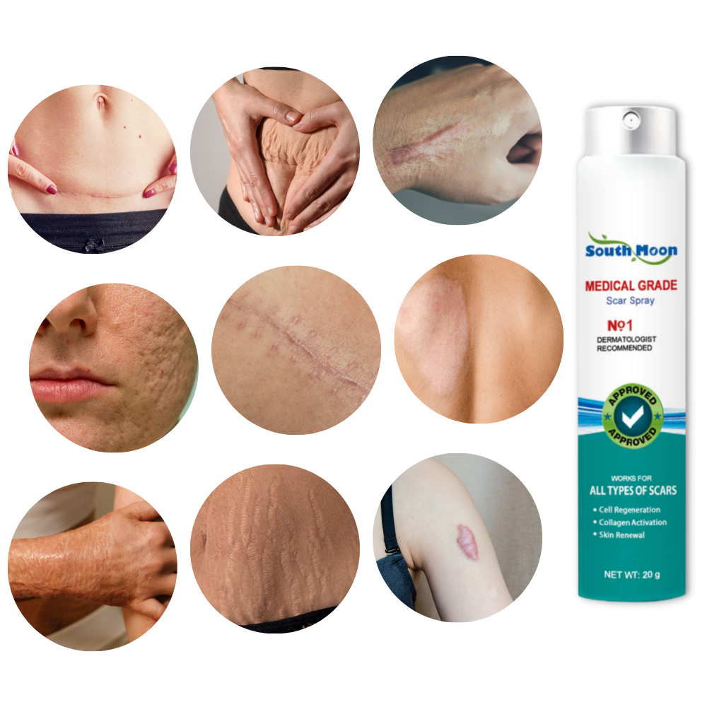 Scar Removal Spray Therapy