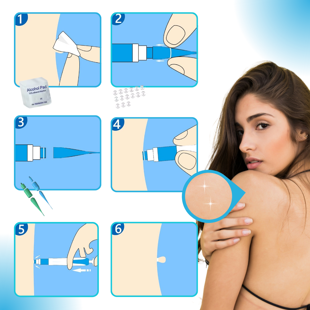 Skin Tag Removal Pro