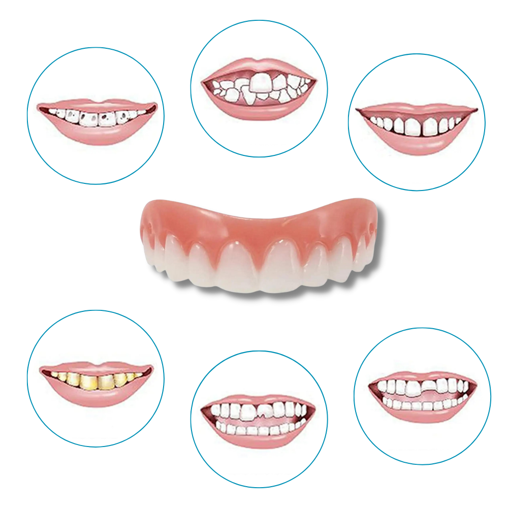 Snap-On Veneer Teeth